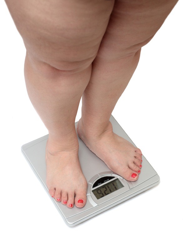 Get your weight in check: by Dr. Seun Sowemimo, weight loss surgeon at Prime Surgicare, Monmouth County, New Jersey