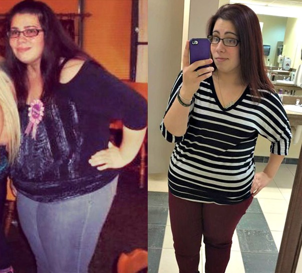 Bariatric Success Stories - Sterling Surgicare