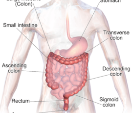 Colon Surgery Can Help When Medications and Other Treatments Fail