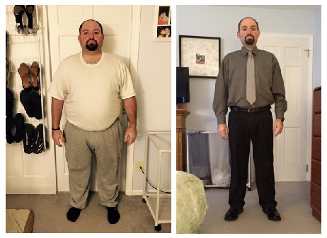 Adam Reich before and after gastric sleeve weight loss surgery at Prime Surgicare, New Jersey.