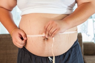 Obesity is a Multi-Pronged Disease — by Dr. Seun Sowemimo, bariatric and general surgeon, Central New Jersey.