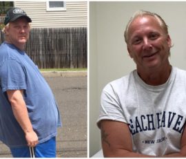 Michael Chaillet Checks in 3 Months After Gastric Sleeve Surgery