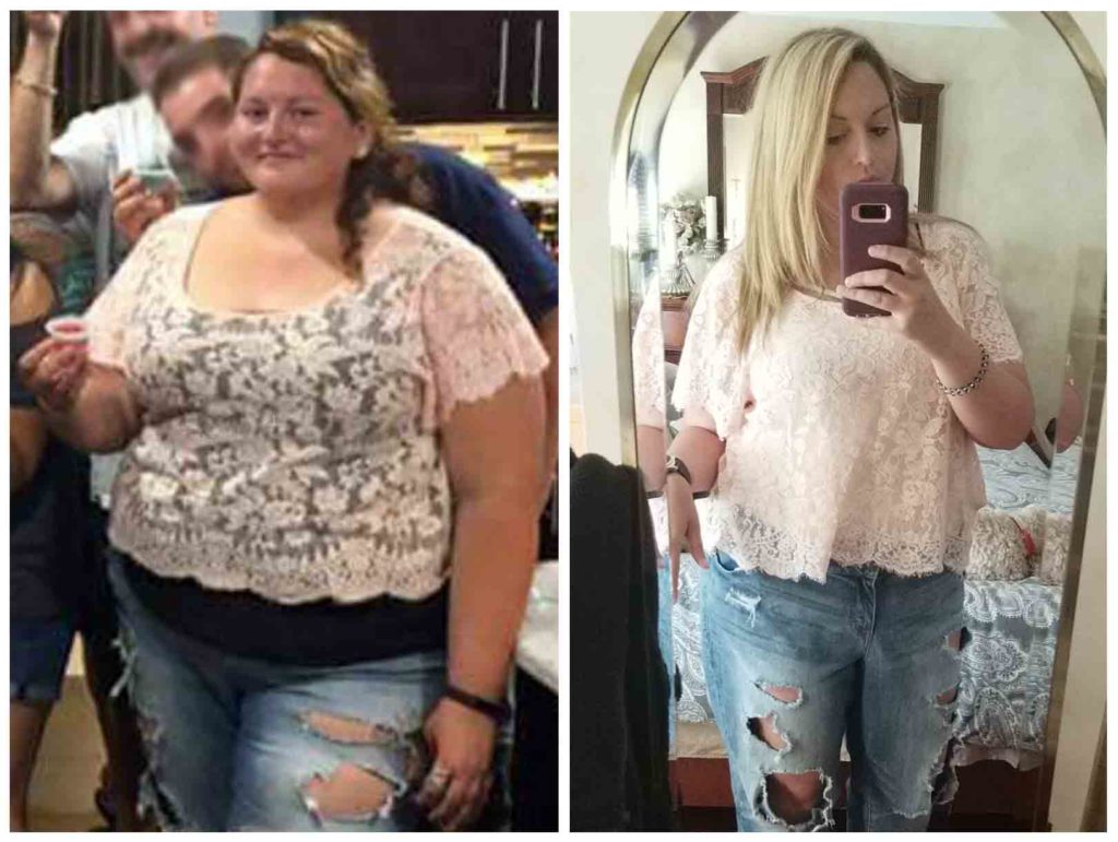 26-Year-Old Woman Loses 110 Lbs. After Gastric Sleeve Surgery and