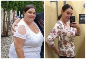 Bariatric testimonials — Carissa before and after gastric sleeve surgery at Prime Surgicare, NJ.