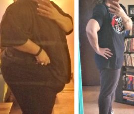 Kimberly celebrates 215-pound weight loss after gastric sleeve bariatric  surgery — Prime Surgicare
