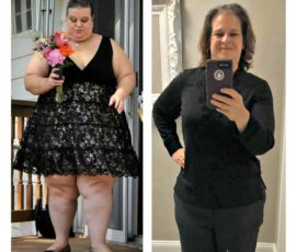 Kimberly celebrates 215-pound weight loss after gastric sleeve bariatric surgery
