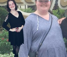 Restaurant Server Loses 100 Pounds after Bariatric Sleeve Surgery