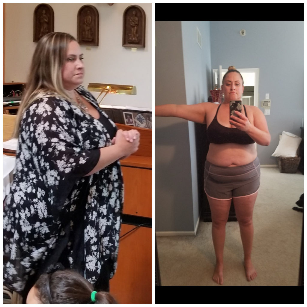 catherine before bariatric weight loss surgery