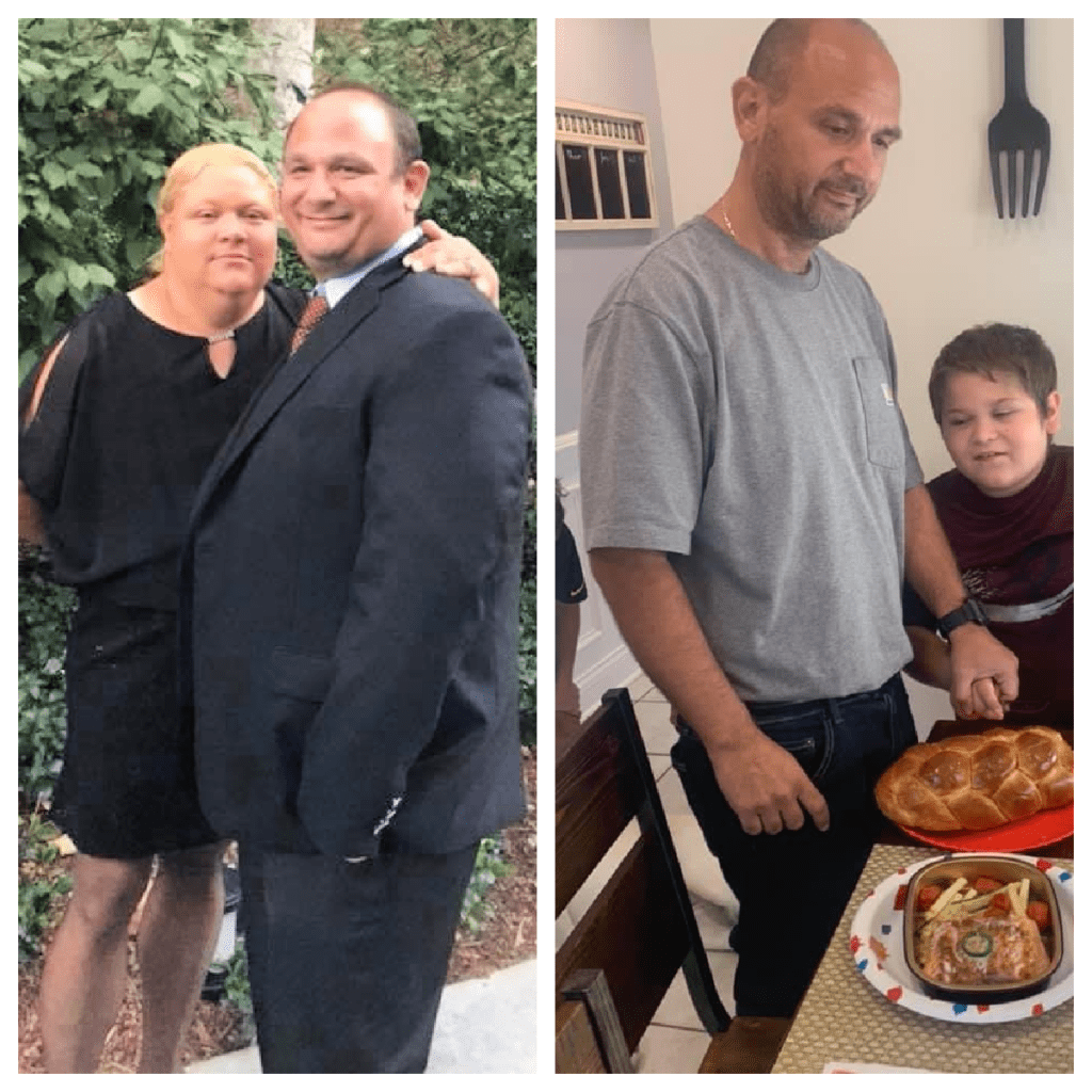 Gastric Sleeve Weight Loss Surgery Helps Man Lose 170 Pounds in 8 Months