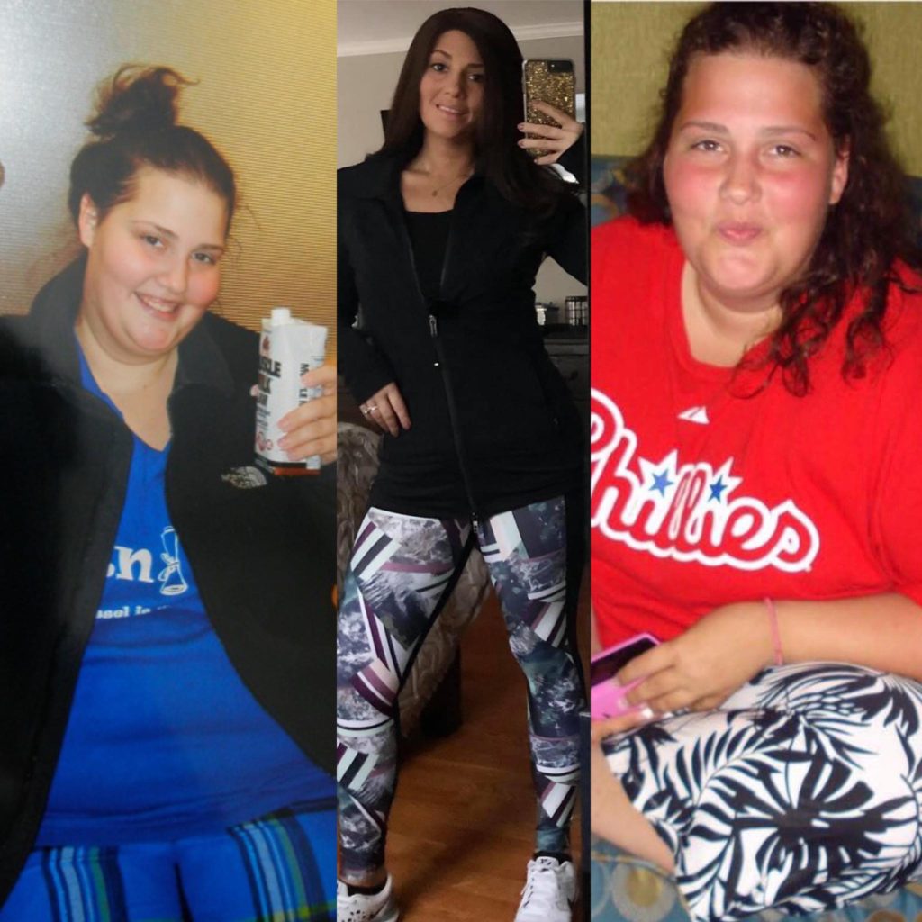 Ten Years After Gastric Bypass How