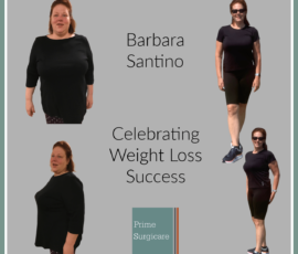 Kimberly celebrates 215-pound weight loss after gastric sleeve bariatric  surgery — Prime Surgicare
