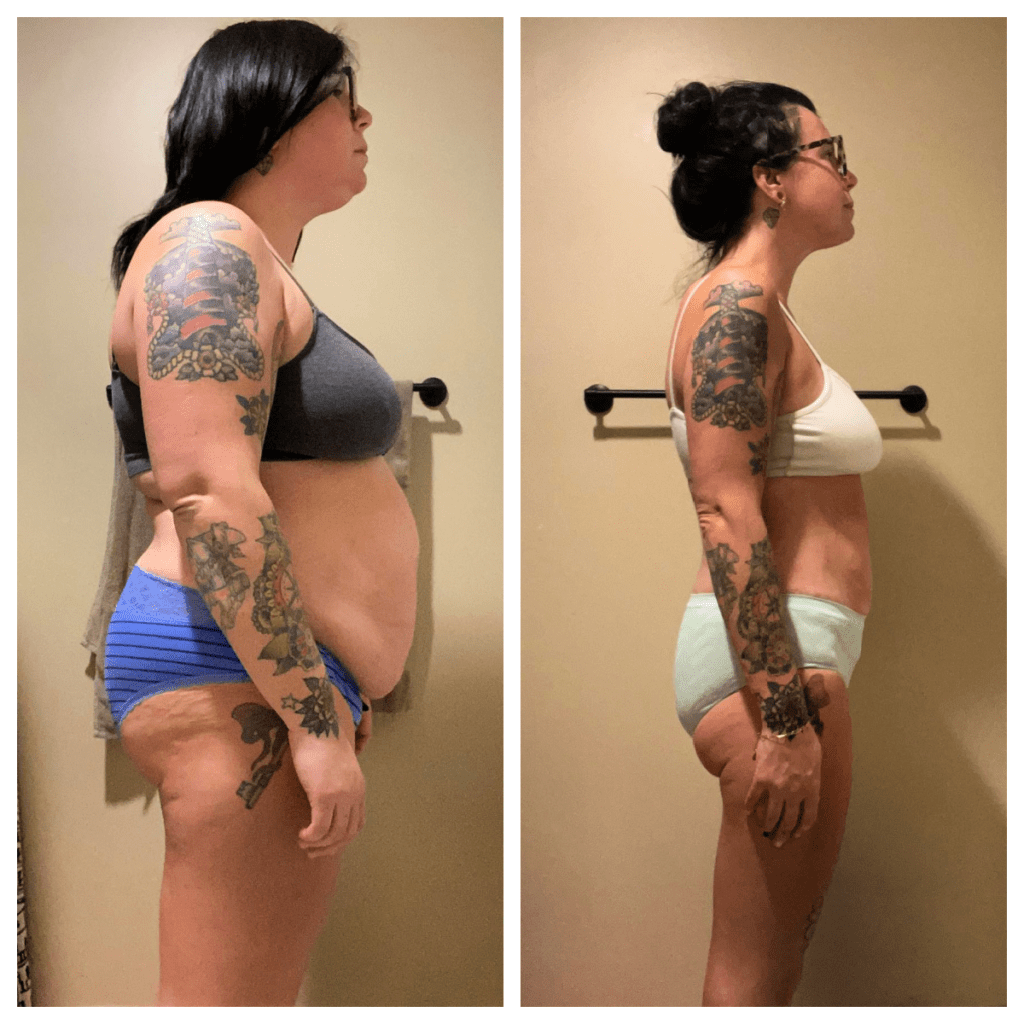 Perri Celebrates Her Transformation One Year After Weight Loss Surgery Prime Surgicare