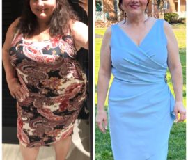Gastric Sleeve Pre-Op Reveals Undiagnosed Heart Condition