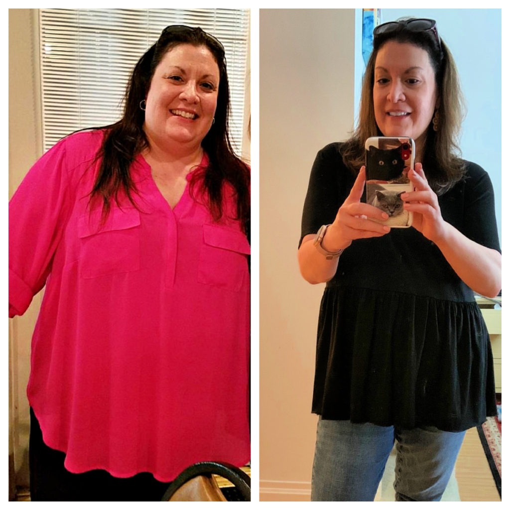 Bergen County Teacher Overhauls Her Health Starting with Gastric Sleeve  Surgery — Prime Surgicare