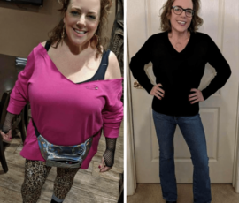 Meghan Bannerman: How Weight Loss Surgery Changed My Life