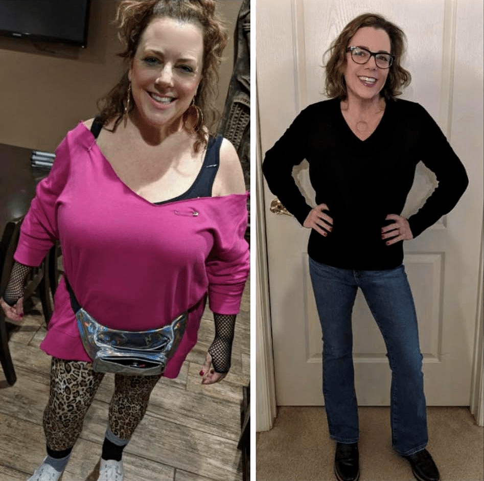 Jackson, NJ resident Megan chose Dr. Seun Sowemimo to perform her bariatric surgery and she lost more than 80 pounds after gastric sleeve surgery.