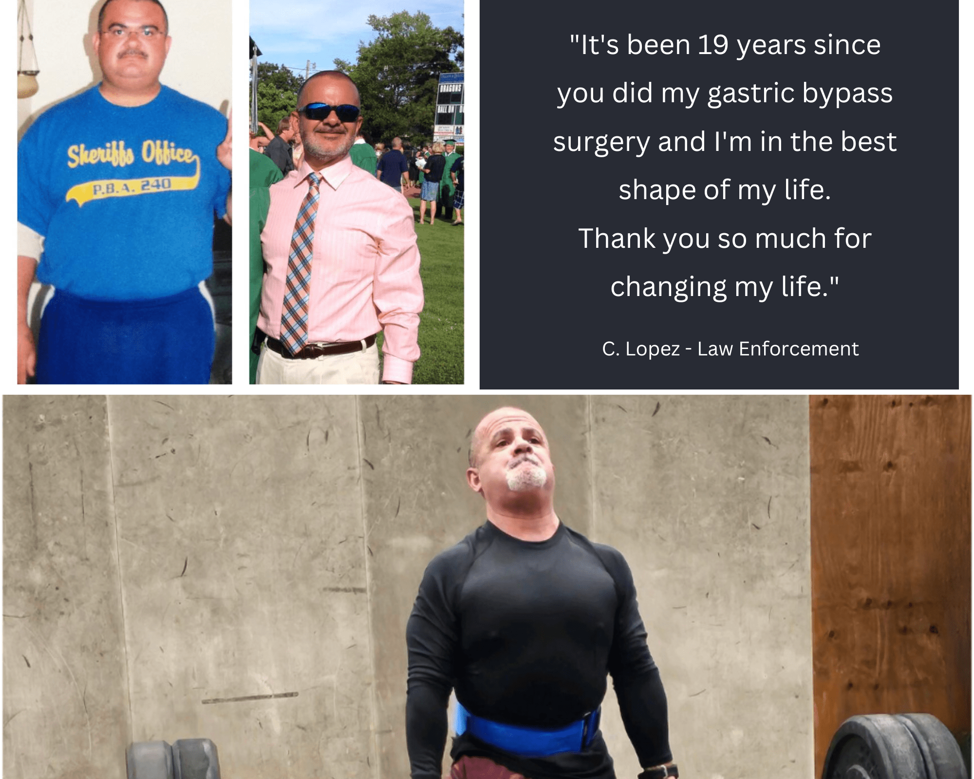 monroe township resident loses 100 punds after gastric bypass surgery